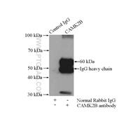 CAMK2B Rabbit Polyclonal Antibody (11533-1-AP)