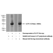 IL1F7 Rabbit Polyclonal Antibody (11863-1-AP)