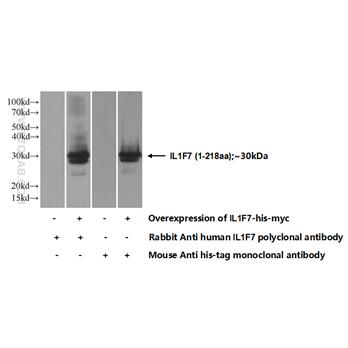 IL1F7 Rabbit Polyclonal Antibody (11863-1-AP)