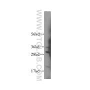 LY96 Rabbit Polyclonal Antibody (11784-1-AP)