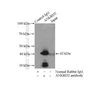 ANKRD2 Rabbit Polyclonal Antibody (11821-1-AP)