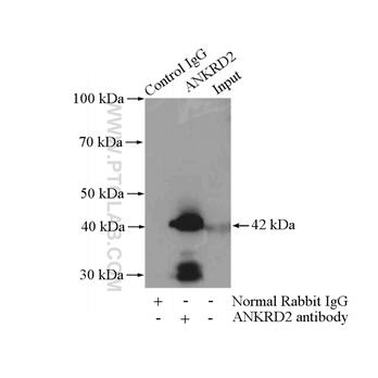 ANKRD2 Rabbit Polyclonal Antibody (11821-1-AP)