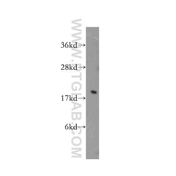 EIF5A Rabbit Polyclonal Antibody (11309-1-AP)
