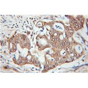 PSMB1 Rabbit Polyclonal Antibody (11749-1-AP)