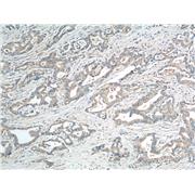 PROCR Rabbit Polyclonal Antibody (11391-1-AP)
