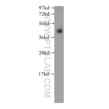 CD207 Rabbit Polyclonal Antibody (11841-1-AP)