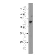 BCL7B Rabbit Polyclonal Antibody (11740-1-AP)