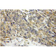 HSD17B6 Rabbit Polyclonal Antibody (11855-1-AP)