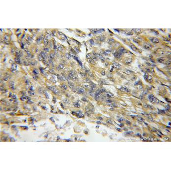 HSD17B6 Rabbit Polyclonal Antibody (11855-1-AP)