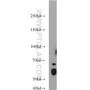 KLF4 Rabbit Polyclonal Antibody (11880-1-AP)