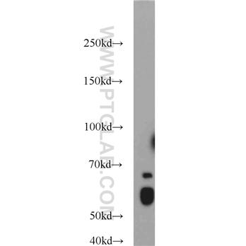 KLF4 Rabbit Polyclonal Antibody (11880-1-AP)
