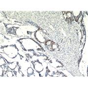 SPRR3 Rabbit Polyclonal Antibody (11742-1-AP)