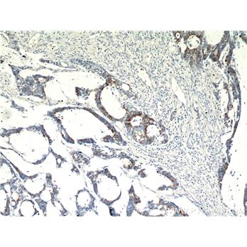 SPRR3 Rabbit Polyclonal Antibody (11742-1-AP)