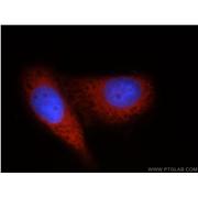 DDX20 Rabbit Polyclonal Antibody (11324-1-AP)