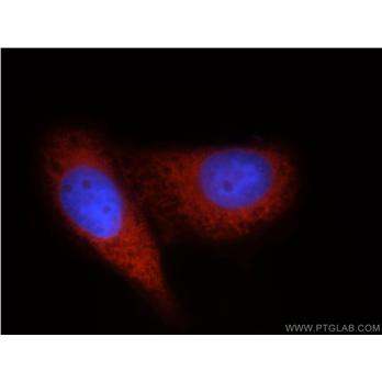 DDX20 Rabbit Polyclonal Antibody (11324-1-AP)