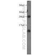 NIPSNAP3B Rabbit Polyclonal Antibody (11789-1-AP)