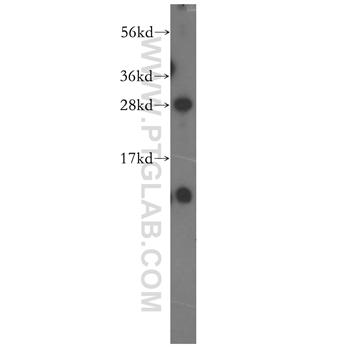 NIPSNAP3B Rabbit Polyclonal Antibody (11789-1-AP)