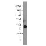 GBP2 Rabbit Polyclonal Antibody (11854-1-AP)