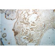 BRD3 Rabbit Polyclonal Antibody (11859-1-AP)