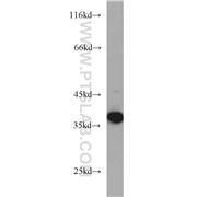 ITLN1 Rabbit Polyclonal Antibody (11770-1-AP)