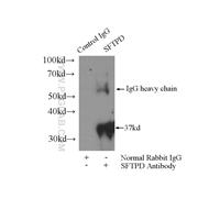 SFTPD Rabbit Polyclonal Antibody (11839-1-AP)