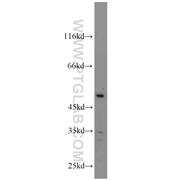 TNFSF13B Rabbit Polyclonal Antibody (11862-1-AP)