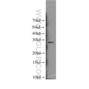 ENOPH1 Rabbit Polyclonal Antibody (11763-1-AP)