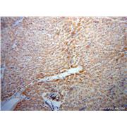 RBP5 Rabbit Polyclonal Antibody (11843-1-AP)