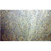 FGL2 Rabbit Polyclonal Antibody (11827-1-AP)