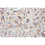 TOMM20 Rabbit Polyclonal Antibody (11802-1-AP)