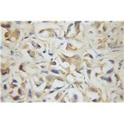 DLEU1 Rabbit Polyclonal Antibody (11860-1-AP)