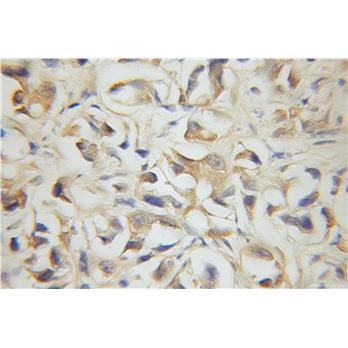DLEU1 Rabbit Polyclonal Antibody (11860-1-AP)