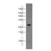 CDC42EP2 Rabbit Polyclonal Antibody (11824-1-AP)