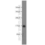 SH2D1A Rabbit Polyclonal Antibody (11868-1-AP)
