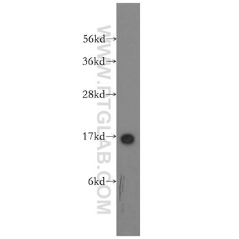 SH2D1A Rabbit Polyclonal Antibody (11868-1-AP)