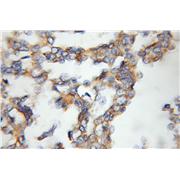 RAMP3 Rabbit Polyclonal Antibody (11861-1-AP)