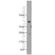 VPS37A Rabbit Polyclonal Antibody (11870-1-AP)