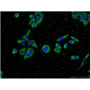 CFL2 Rabbit Polyclonal Antibody (11848-1-AP)