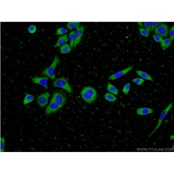 CFL2 Rabbit Polyclonal Antibody (11848-1-AP)