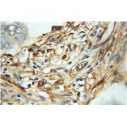 LGALS1 Rabbit Polyclonal Antibody (11858-1-AP)