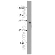 FKBP3 Rabbit Polyclonal Antibody (11755-1-AP)