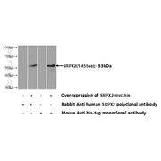 SRPX2 Rabbit Polyclonal Antibody (11845-1-AP)