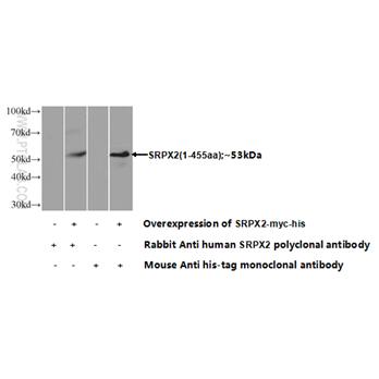 SRPX2 Rabbit Polyclonal Antibody (11845-1-AP)