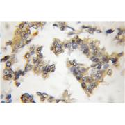 CIB1 Rabbit Polyclonal Antibody (11823-1-AP)