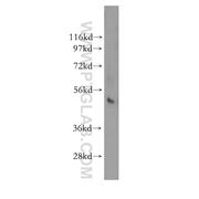 NFKBIE Rabbit Polyclonal Antibody (11273-1-AP)