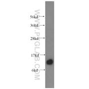 SPCS1 Rabbit Polyclonal Antibody (11847-1-AP)