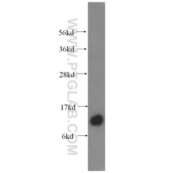SPCS1 Rabbit Polyclonal Antibody (11847-1-AP)