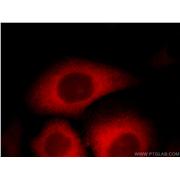 TPD52L2 Rabbit Polyclonal Antibody (11795-1-AP)