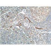 VWF Rabbit Polyclonal Antibody (11778-1-AP)