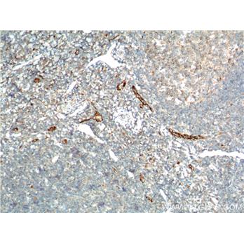 VWF Rabbit Polyclonal Antibody (11778-1-AP)